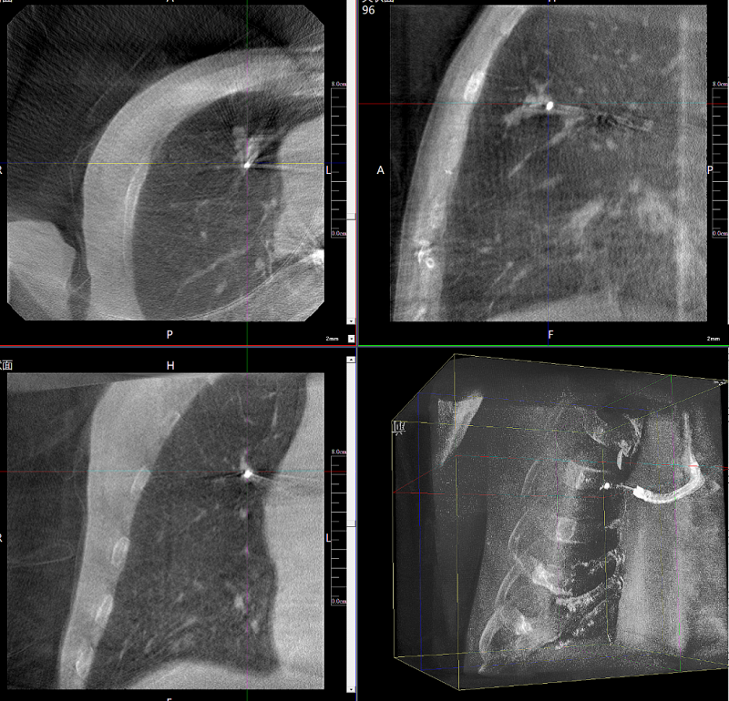 三维C形臂图像 三维C形臂图像