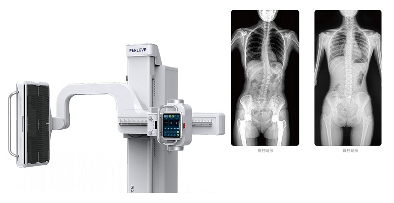 大平板DR 大平板DR