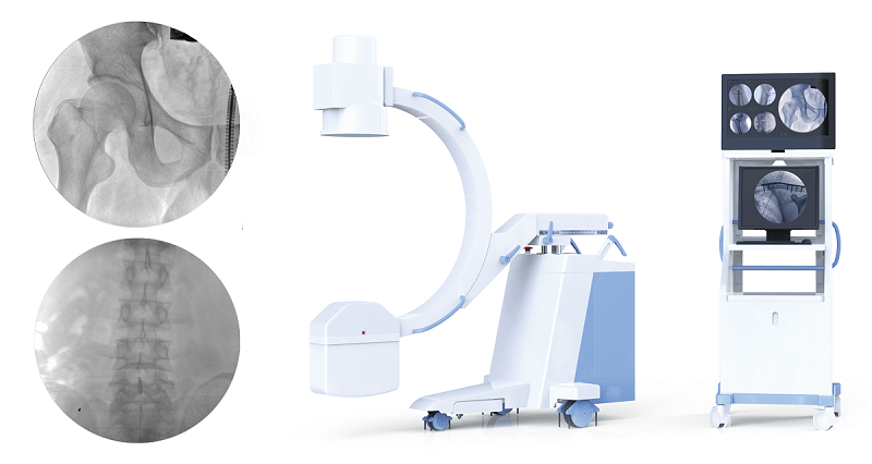影增骨科小C 影增骨科小C